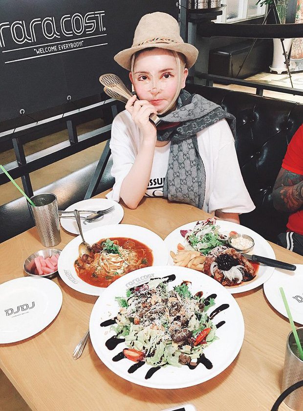 Chi gần 50 triệu đồng để cắt mí tại spa của hot girl dao kéo Vân Tokyo, cô gái sống dở chết dở vì không nhắm được mắt-3