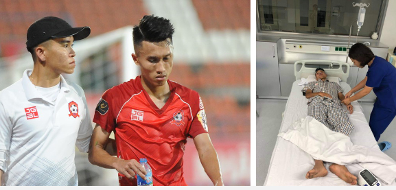 Mặt cầu thủ V.League biến dạng sau va chạm cực mạnh, nhập viện ngay trong đêm-1