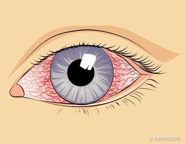 9 cách tự nhiên và đơn giản giúp làm sạch phổi-3