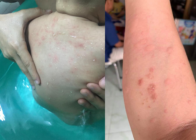 Dân chung cư TP.HCM bất an vì nước vàng khè, có bọ-1