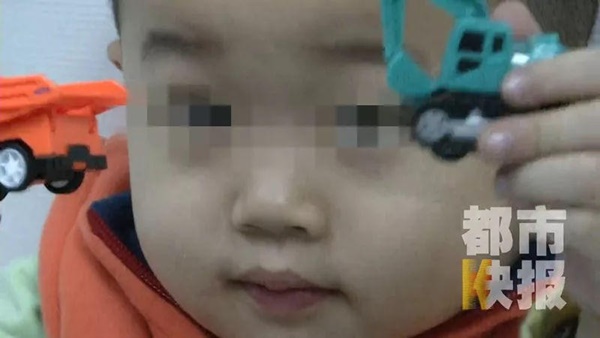 Bé trai 3 tuổi bị mù suốt 10 ngày chỉ vì bị cảm lạnh nhưng không điều trị dứt điểm-2