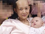 Nữ tiến sĩ 31 tuổi với hơn 500 ngày chống lại căn bệnh ung thư vú, cảnh tỉnh giới trẻ bỏ ngay những thói quen này-4