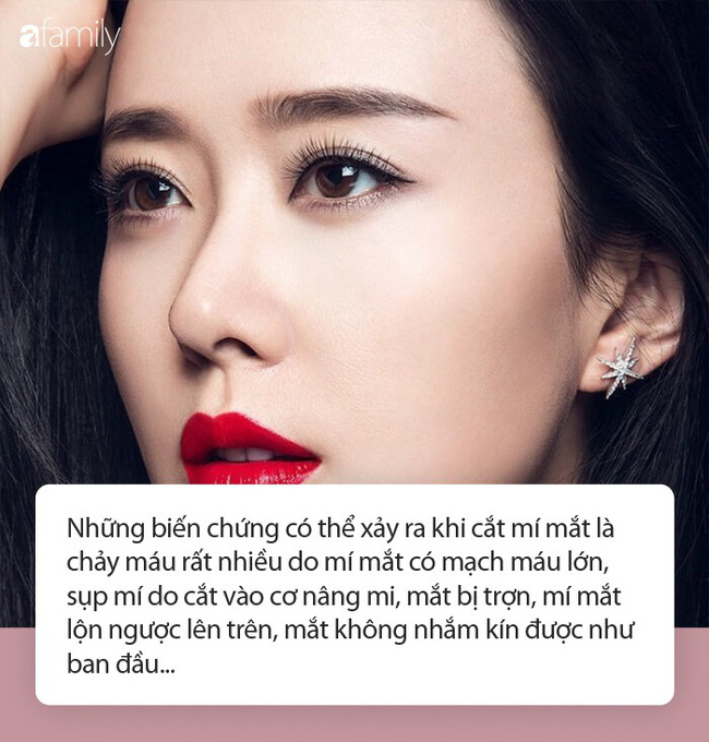 Thêm 1 phụ nữ kêu cứu sau khi đi cắt mí mắt bị hỏng: Đây là những điều bạn cần nhớ trước khi làm phẫu thuật này-2