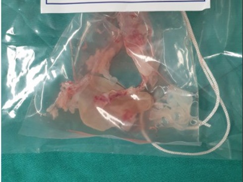 Kiểu ăn ngon miệng nhưng tích chất độc trong não, gây bệnh nan y-2