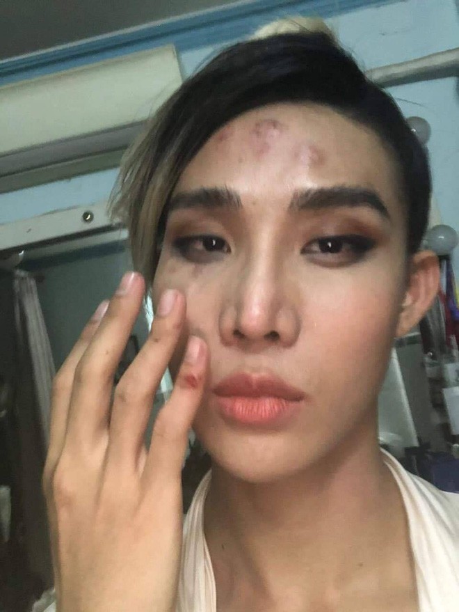 Tài xế xe ôm công nghệ nghi đánh đập, hành hung một người mẫu tại Sài Gòn-3