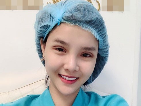 Sau nhiều tháng “dao kéo”, Kỳ Hân vẫn bị dân tình chê bai khuôn mặt thua xa quá khứ