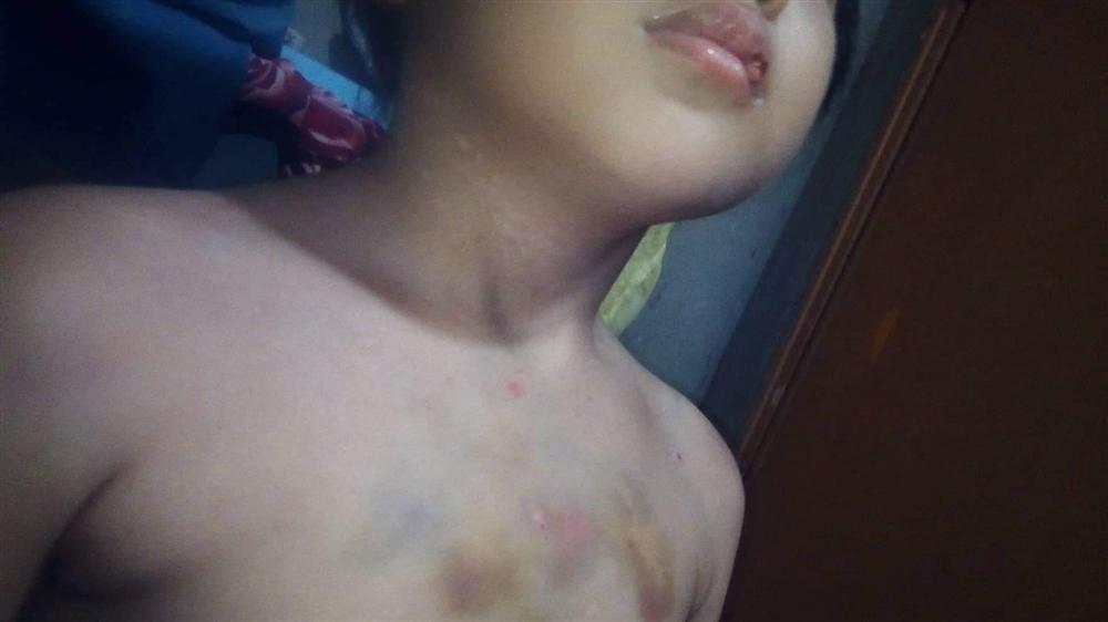 Nghi vấn bé gái bị cha dượng bạo hành, châm tàn thuốc vào vùng kín khiến dư luận phẫn nộ-3