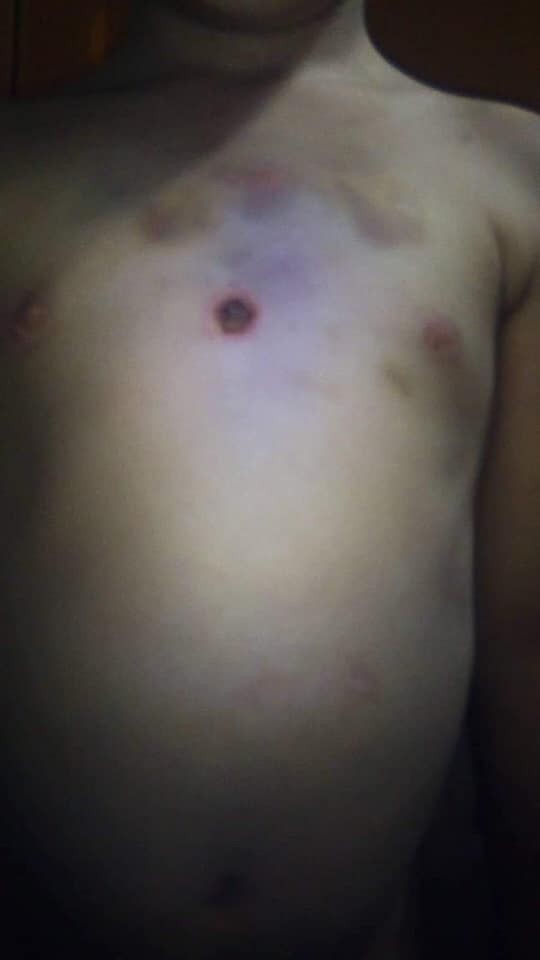 Nghi vấn bé gái bị cha dượng bạo hành, châm tàn thuốc vào vùng kín khiến dư luận phẫn nộ-4