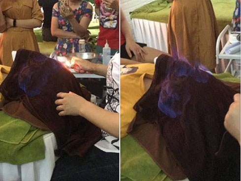 “Tá hỏa” với phương pháp đốt lửa lên mặt để làm đẹp da: Chuyên gia lý giải tường tận thông tin ai nghe xong cũng giật mình