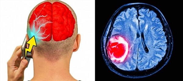 4 vị trí không nên đặt điện thoại nhưng nhiều người vẫn làm sai, gây nguy cơ vô sinh-1