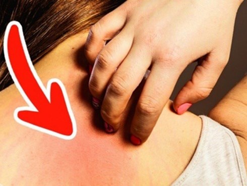 7 dấu hiệu cảnh báo ung thư sớm, 90% mọi người thường bỏ qua