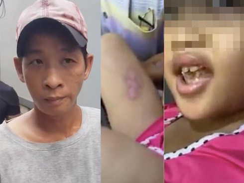 Người cha dượng hành hạ, châm thuốc lá vào người bé gái 6 tuổi khai gì với công an?
