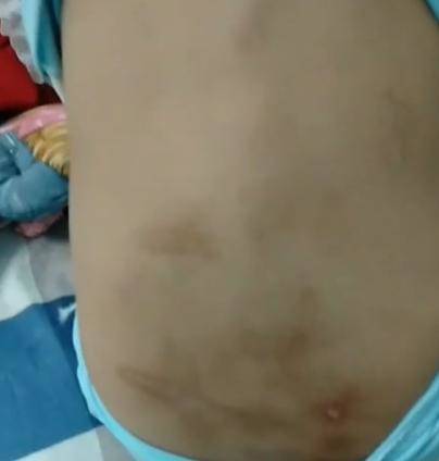 Phẫn nộ khi nghe về quá trình cha dượng châm tàn thuốc, bạo hành cơ thể qua lời bé gái-4