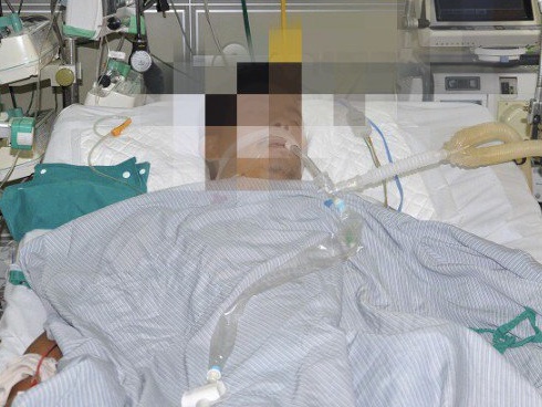Bác sĩ Nhi khoa cảnh báo thêm một loạt virus cực nguy hiểm, dễ dàng lây khi hôn trẻ nhỏ-6
