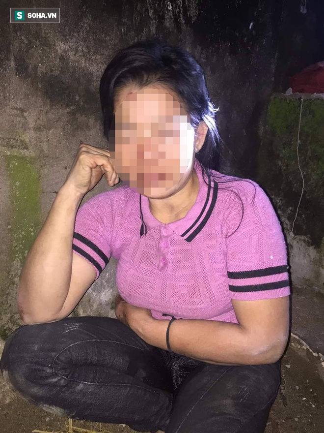 Một phụ nữ bị kẻ lạ đánh đập dã man vào vùng kín trong đêm-1