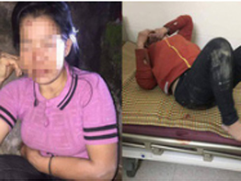 Vụ người phụ nữ U60 bị kẻ lạ đâm vào vùng kín giữa đường: Thủ phạm là người tình kém 13 tuổi ghen tuông-3