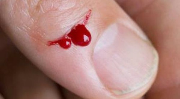 Tránh xa gừng nếu bạn mắc các bệnh sau kẻo hối không kịp-1