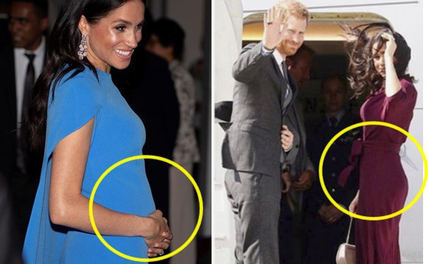 Công nương Kate bất ngờ dính nghi án nhờ người mang thai hộ khi sinh cả 3 người con với những bằng chứng cụ thể-3