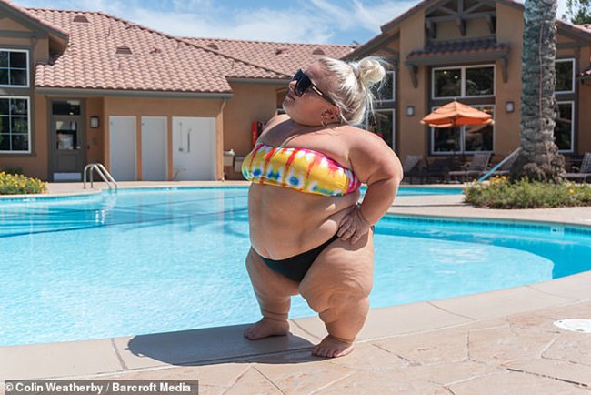 Sở hữu ngoại hình nấm lùn, cô gái sống trong bóng tối suốt cả cuộc đời suýt tự tử, cuối cùng tự vực dậy mình khiến ai cũng ngưỡng mộ-1