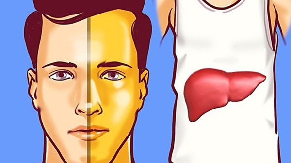 Nếu 4 dấu hiệu này xuất hiện trên mặt thì gan đã bị tổn thương trầm trọng, đừng chần chừ mà hãy đi khám gấp-1