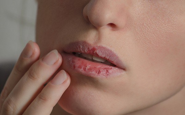 Nếu 4 dấu hiệu này xuất hiện trên mặt thì gan đã bị tổn thương trầm trọng, đừng chần chừ mà hãy đi khám gấp-2