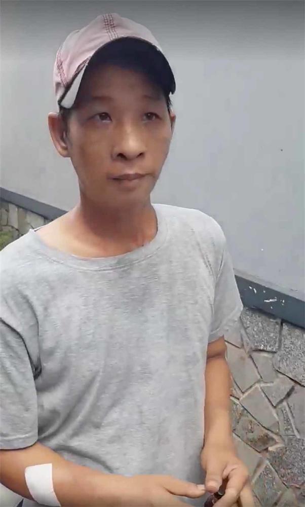 Lời khai của cha dượng hành hạ, dí thuốc lá vào vùng kín bé 6 tuổi-1