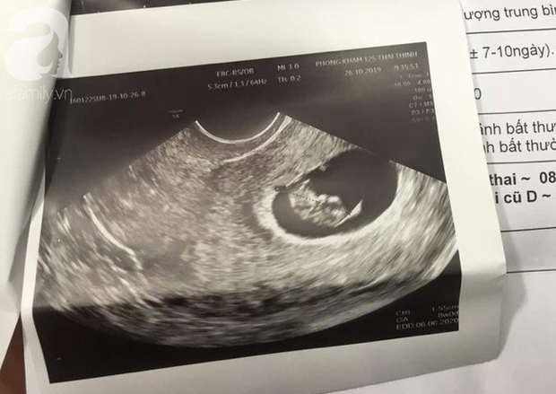 Người phụ nữ 28 tuổi đứng trước nguy cơ mất con sau khi hút mỡ bụng tại BV thẩm mỹ mà không biết đang mang thai 4 tuần-1
