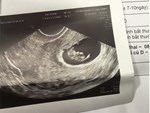 BV lên tiếng vụ người phụ nữ hút mỡ bụng xong mới biết có thai: Bác sĩ phẫu thuật không xét nghiệm thai cho khách hàng-3