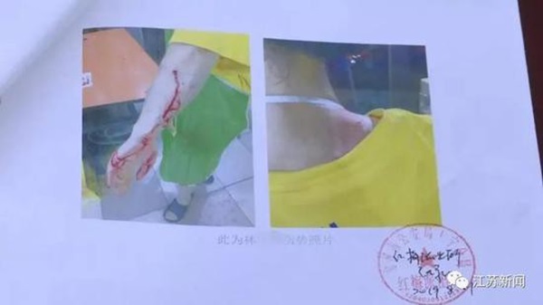 Con gái ế 30 tuổi bị mẹ đánh đến trọng thương, nguyên nhân đằng sau khiến người ta vừa thương, vừa giận nạn nhân-1