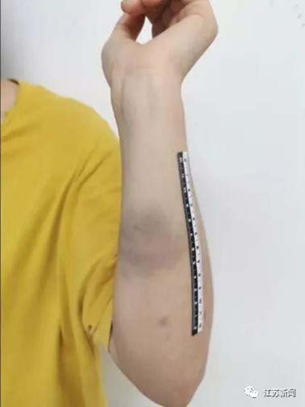 Con gái ế 30 tuổi bị mẹ đánh đến trọng thương, nguyên nhân đằng sau khiến người ta vừa thương, vừa giận nạn nhân-2