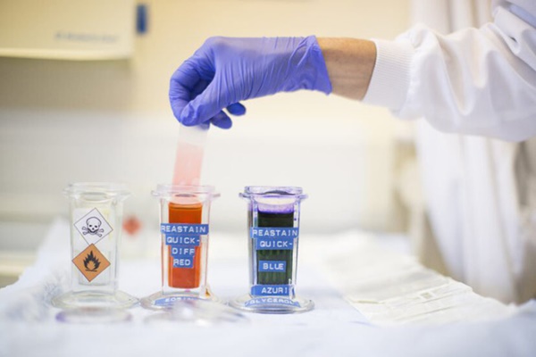 Thụ tinh của người cao 1m8 nhưng sinh con mắc bệnh lùn, bà mẹ ôm cay đắng đâm đơn kiện ngân hàng tinh trùng-3