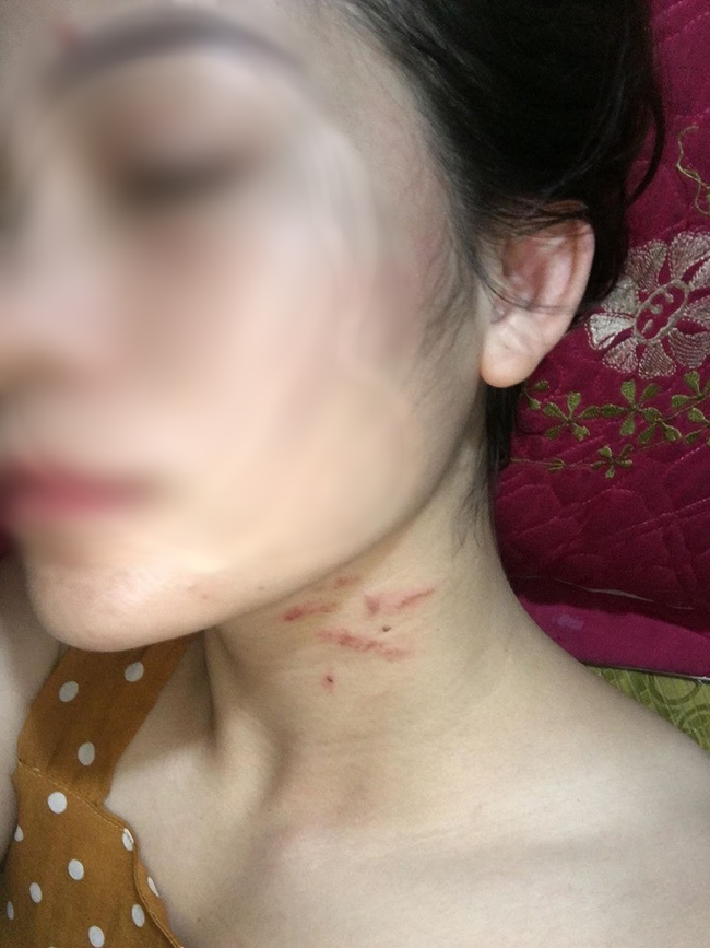 Mẹ trẻ cùng 3 con nhỏ cầu cứu cộng đồng mạng vì bị chồng bạo hành dã man, cầm dao dọa giết gây ám ảnh tâm lý nặng nề-2