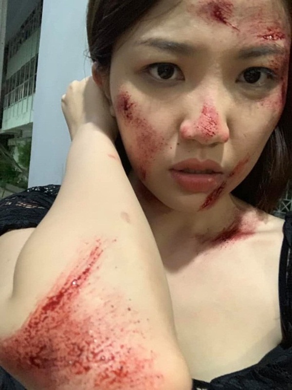 Lương Thanh tung ảnh hé lộ cái kết thảm của Trà tiểu tam: Thân tàn ma dại đến mức nào sau khi tạo nghiệp?-2