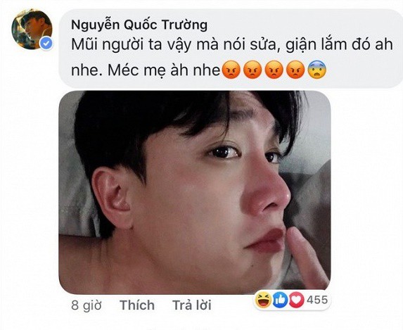 Sau Việt Anh, Quốc Trường vướng nghi án phẫu thuật thẩm mỹ mũi và đây là câu trả lời không ngờ của nam diễn viên-4