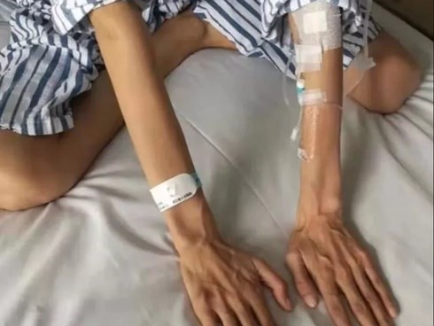 Hội chứng lạ khiến người phụ nữ có chân tay gầy, dài bất thường