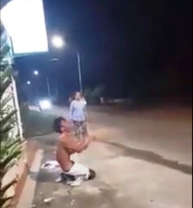 Công an vào cuộc xác minh clip nam thanh niên nghi bị người thân đổ nước sôi lên người gây bỏng nặng-1