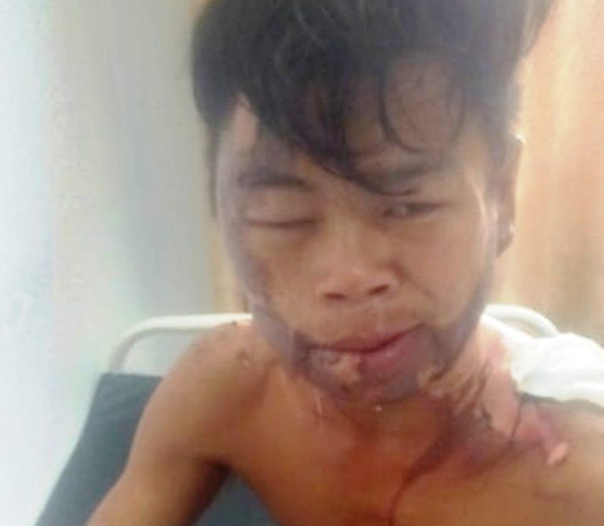 Tiết lộ bất ngờ của ông bố có con gái tưới nước sôi lên người con trai-1