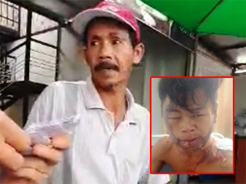 Giận chồng, vợ mang thai 37 tuần đổ xăng lên người châm lửa đốt-2