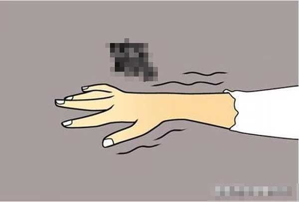 Tê ngón tay: Dấu hiệu của 7 bệnh nguy hiểm, nhận biết sớm và xử lý kịp thời kẻo hối hận không kịp-3