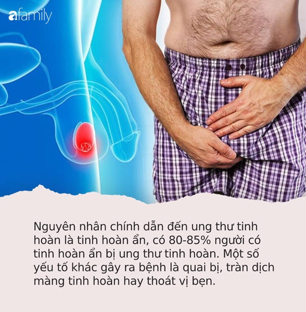 Vợ nhắc chồng: Tự làm điều này trước gương 1 lần/ngày để phát hiện sớm mình có mắc ung thư tinh hoàn hay không-1