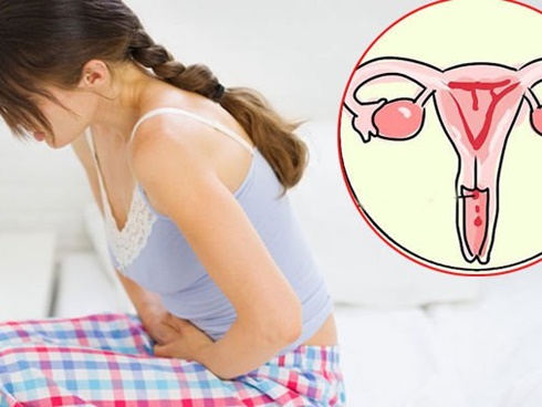 3 dấu hiệu mà cơ thể lên tiếng” trước khi bị ung thư cổ tử cung nhưng rất nhiều phụ nữ bỏ qua-4