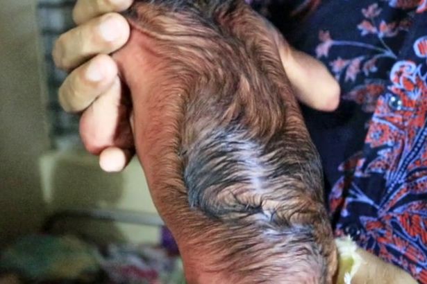 Cả ê-kíp bác sĩ đỡ đẻ choáng váng khi em bé chào đời trong hình hài của một ông lão 80 tuổi-3