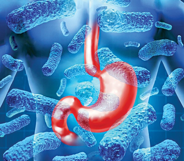 3 kiểu ung thư khiến người bệnh không tin vào nguyên nhân: BS chỉ ra sát thủ giấu mặt-3