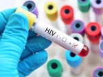 Dấu hiệu phát hiện nhiễm HIV ở nam giới-4