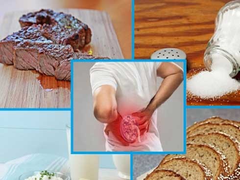 7 loại thực phẩm phổ biến gây hại nghiêm trọng cho thận, số 3 nhiều nhà vẫn ăn hàng ngày