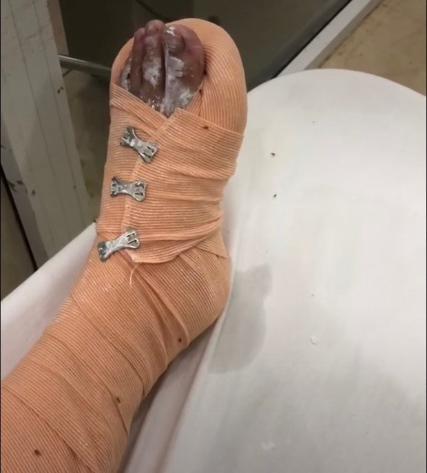 Giải cứu cô gái 21 tuổi nghi bị bạn trai quen qua Facebook đổ xăng lên người định thiêu sống, tra tấn như thời trung cổ-2