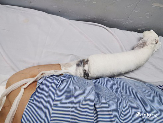 Kinh hoàng giây phút chủ nhà nghỉ bị chém hàng trăm nhát trong đêm-5