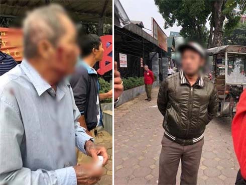 Nhân chứng vụ cụ ông 80 tuổi bị gã xe ôm hành hung: Hắn lấy súng cao su bắn vào mặt, khi thấy ông cụ ngã xuống còn nhảy lên giẫm đạp-5