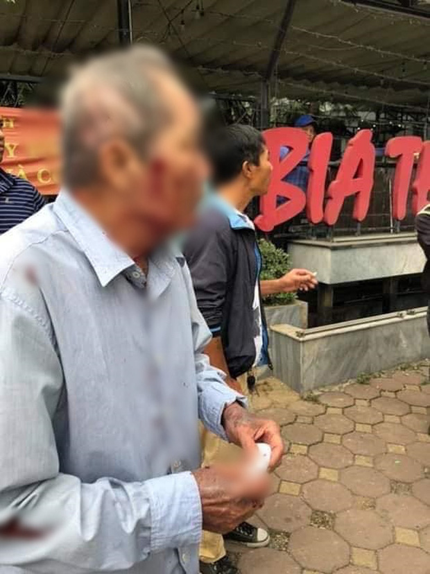 Nhân chứng vụ cụ ông 80 tuổi bị gã xe ôm hành hung: Hắn lấy súng cao su bắn vào mặt, khi thấy ông cụ ngã xuống còn nhảy lên giẫm đạp-2