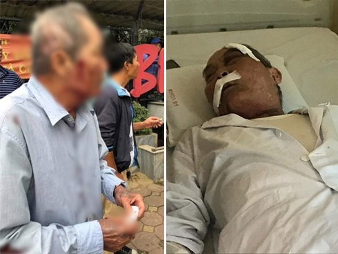 Không cho ôm, cô gái bị người tình đã có gia đình siết cổ đến chết-2